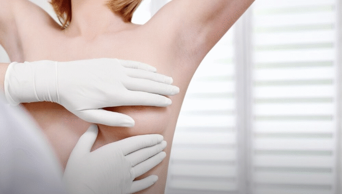 Здоров’я грудей: Самообстеження, профілактика та коли варто звернутися до лікаря